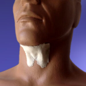 Old Age Neck (Wattle)